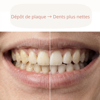 Rituliya — Soin LED pour les gencives