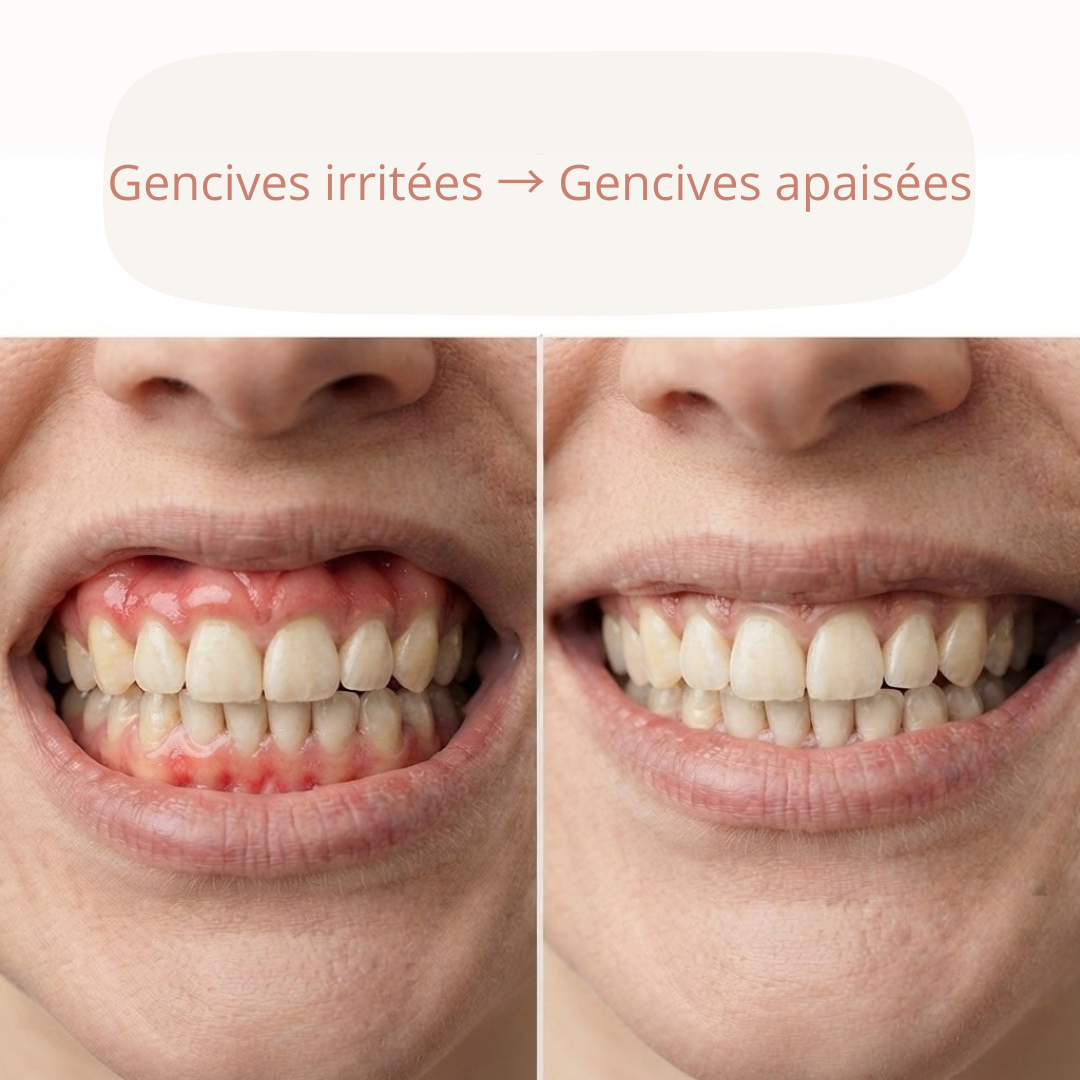 Rituliya — Soin LED pour les gencives